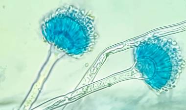 La FBCB - UNL lidera un proyecto clave contra hongos resistentes