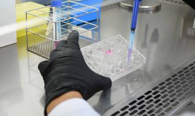 La UNL suma patentes en biotecnología y nanomedicina
